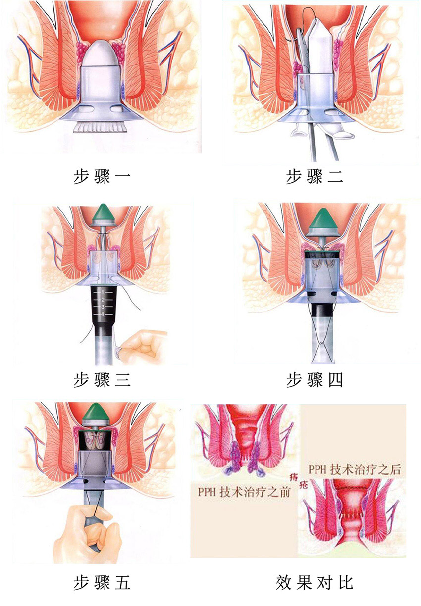 7251569222725756.jpg 45454.jpg